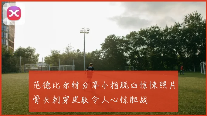 范德比尔特分享小指脱臼惊悚照片骨头刺穿皮肤令人心惊胆战